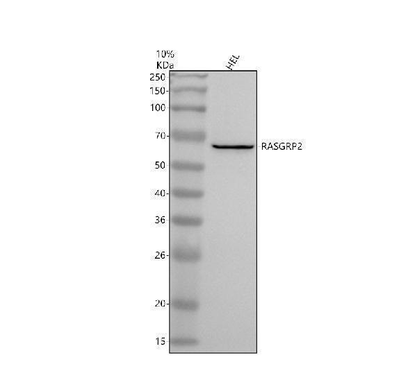 Western blot analysis of RASGRP2 using anti-RASGRP2 antibody (A05007-1)