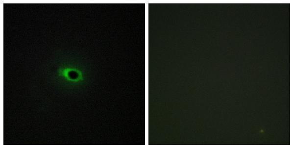 a05008 col12a1 primary antibodies if testing 1