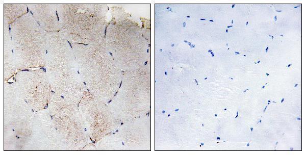 a05008 col12a1 primary antibodies ihc testing 2