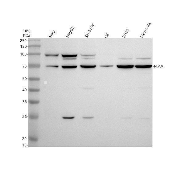 Western blot analysis of PLAA using anti-PLAA antibody (A05010-1)
