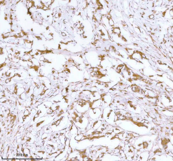  IHC analysis of Stanniocalcin 2/STC2 using anti-Stanniocalcin 2/STC2 antibody (A05017)