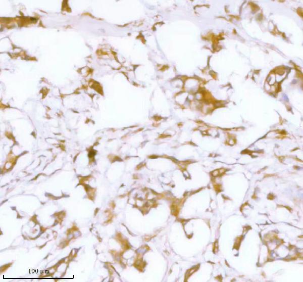  IHC analysis of Stanniocalcin 2/STC2 using anti-Stanniocalcin 2/STC2 antibody (A05017)