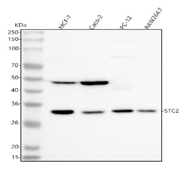  Western blot analysis of Stanniocalcin 2/STC2 using anti-Stanniocalcin 2/STC2 antibody (A05017)