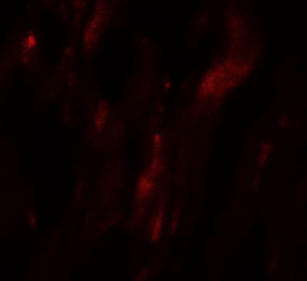 Immunofluorescence of HOPX in human heart tissue with HOPX antibody at 20 μg/mL