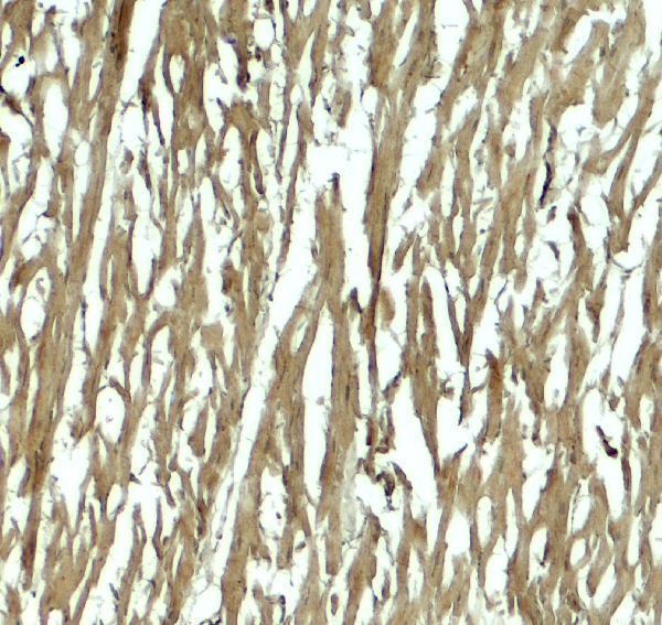 Immunohistochemistry of HOPX in human heart tissue with HOPX antibody at 5 μg/mL