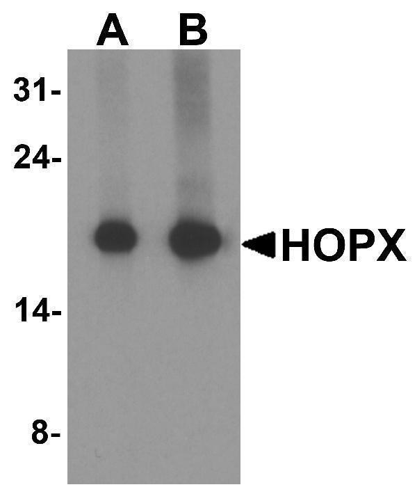Western blot analysis of HOPX in human brain tissue lysate with HOPX antibody at (A) 1 and (B) 2 μg/ml