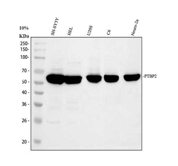 Western blot analysis of PTBP2 using anti-PTBP2 antibody (A05020-2)