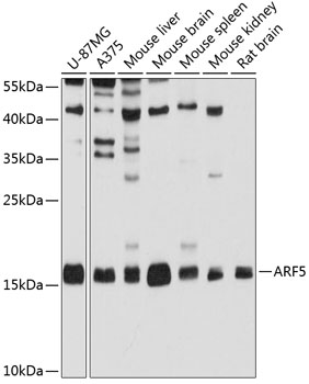 Western blot analysis of extracts of various cell lines, using ARF5 antibody  at 1:1000 dilution