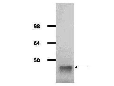 a05022 1 aldoa primary antibodies wb testing 1