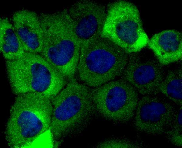 ICC staining Aldolase in A431 cells (green)