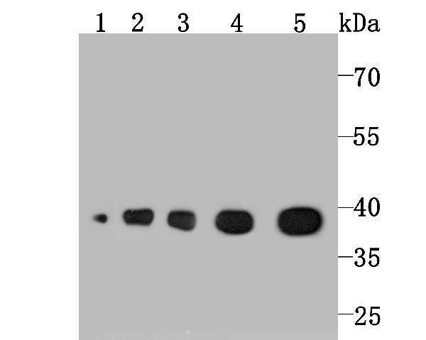 Western blot analysis of Aldolase on different lysates using anti-Aldolase antibody at 1/1,000 dilution