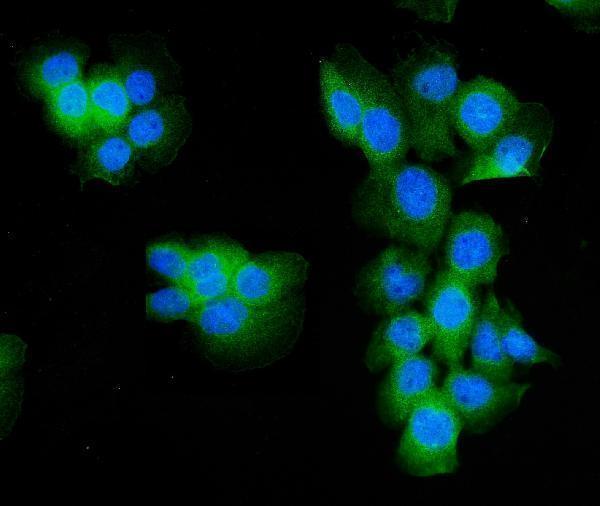 a05022 3 aldoa primary antibodies if testing 7