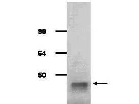 IgG purified antibody to rabbit muscle aldolase (100-1141, 200-1141 and 200-1341) was used at a 1:1000 dilution to detect human aldolase by Western blot