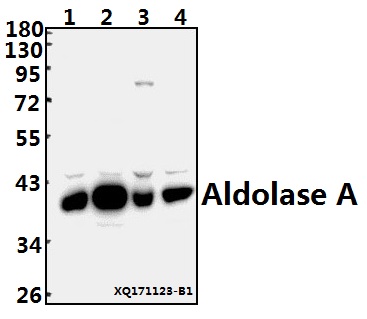 Western blot (WB) analysis of Aldolase A (T9) pAb at 1:500 dilution
Lane1:A549 whole cell lysate(40ug)
Lane2:U-87MG whole cell lysate(40ug)
Lane3:AML-12 whole cell lysate(40ug)
Lane4:PC3 whole cell lysate(40ug)