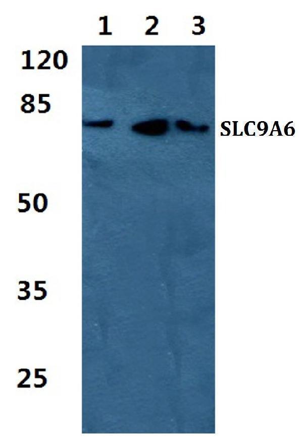 Western blot (WB) analysis of SLC9A6 polyclonal antibody at 1:500 dilution
Lane1:HEK293T cell lysate
Lane2:Raw264
