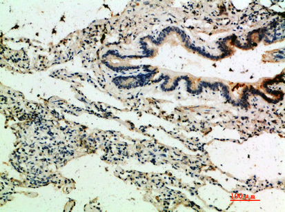 Immunohistochemical analysis of paraffin-embedded human-lung, antibody was diluted at 1:200
