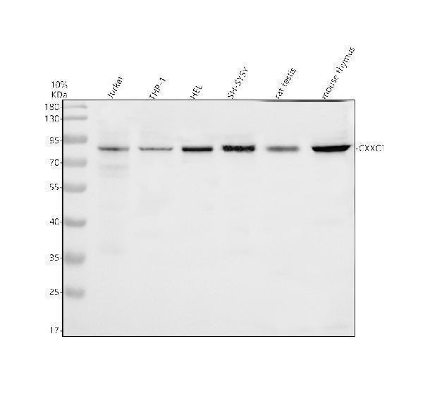 Western blot analysis of CXXC1 using anti-CXXC1 antibody (A05025-1)