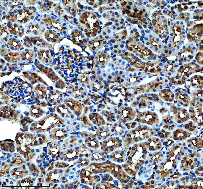 a05029 1 kank1 primary antibodies ihc testing 1