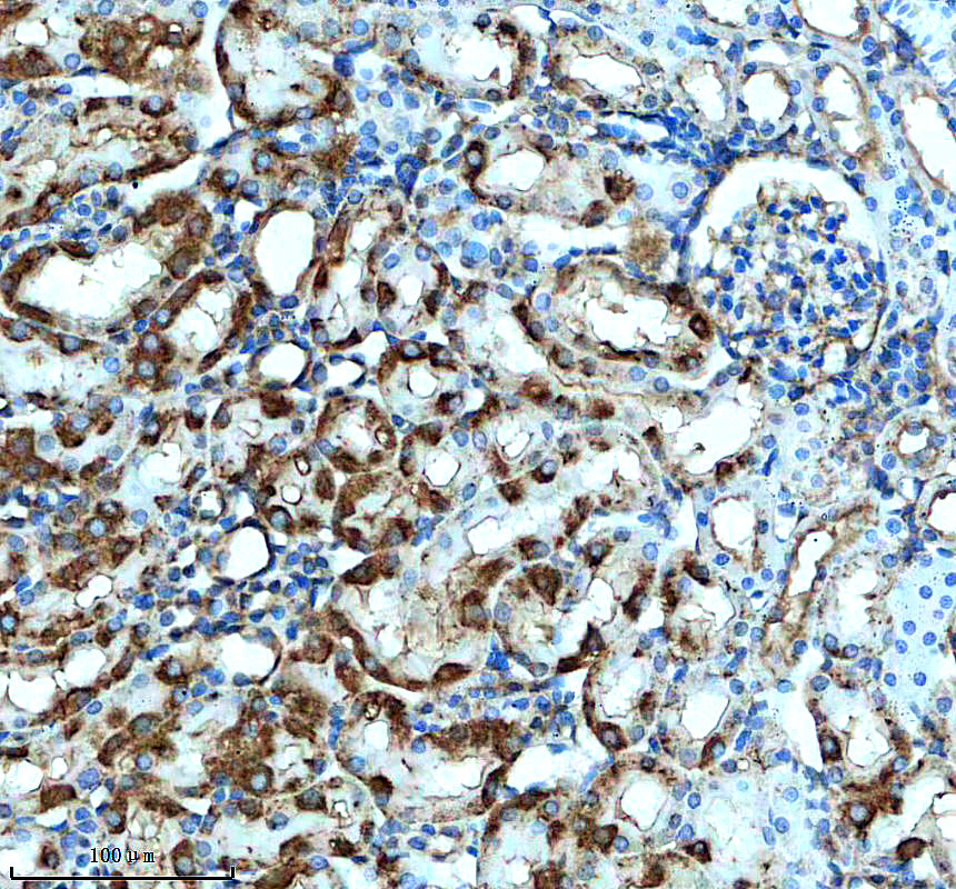 a05029 1 kank1 primary antibodies ihc testing 2