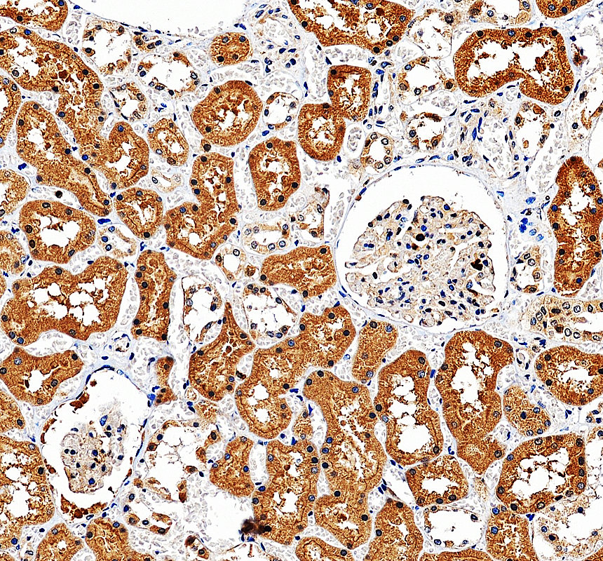 a05029 1 kank1 primary antibodies ihc testing 4
