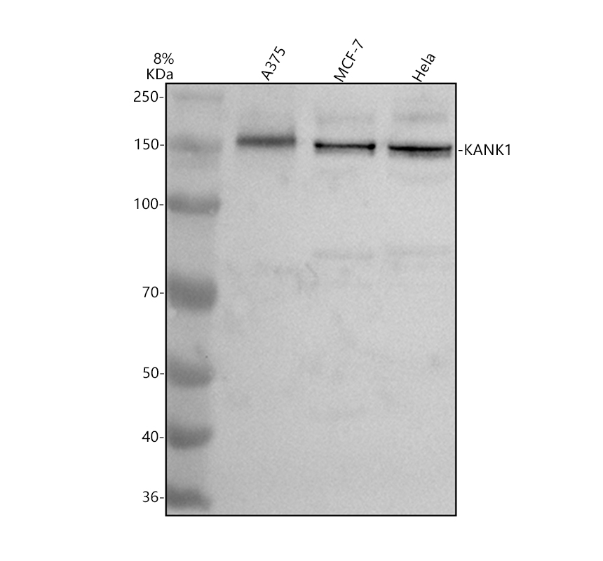 a05029 1 kank1 primary antibodies wb testing 1