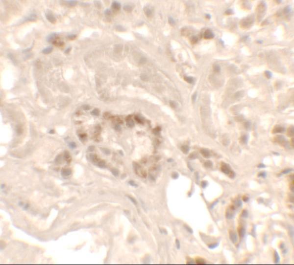a05029 kank1 primary antibodies ihc testing 2