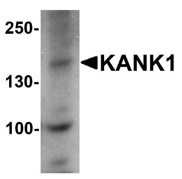 a05029 kank1 primary antibodies wb testing 1