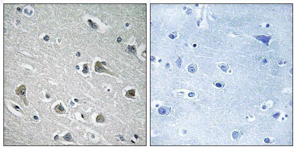 a05031 mylip primary antibodies ihc testing 1