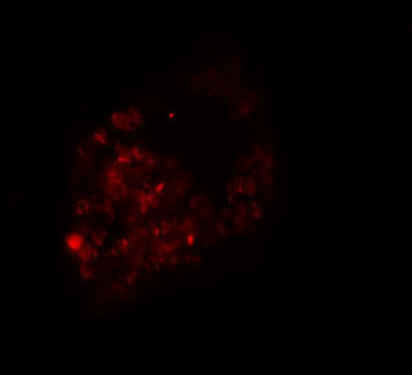 a05038 prickle1 primary antibodies if testing 2