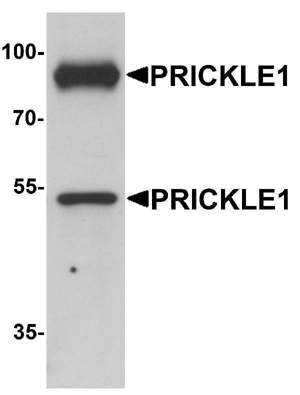 a05038 prickle1 primary antibodies wb testing 1