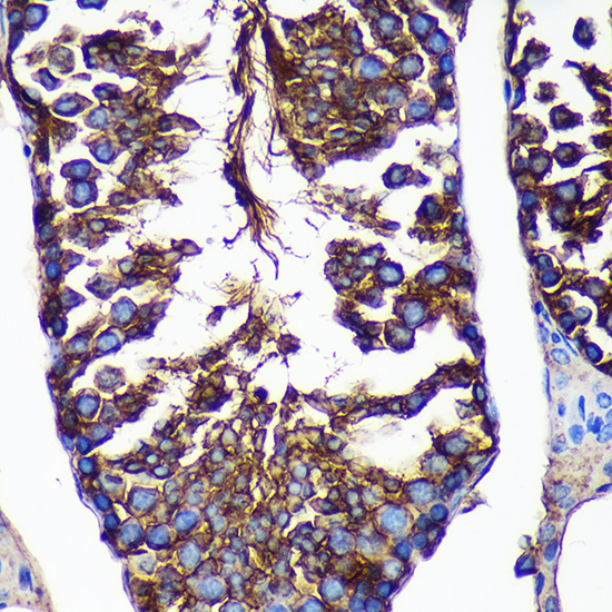 Immunohistochemistry of paraffin-embedded Mouse testis using CTNNA3 Rabbit pAb  at dilution of 1:100 