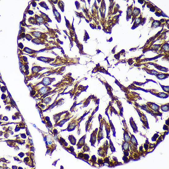 Immunohistochemistry of paraffin-embedded Rat testis using CTNNA3 Rabbit pAb  at dilution of 1:100 