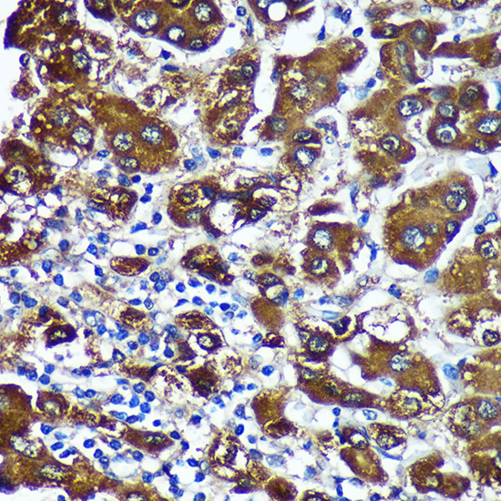 a05039 ctnna3 primary antiboties ihc testing 4