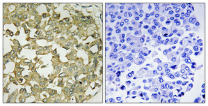 a05042 aplnr primary antibodyes ihc testing 2