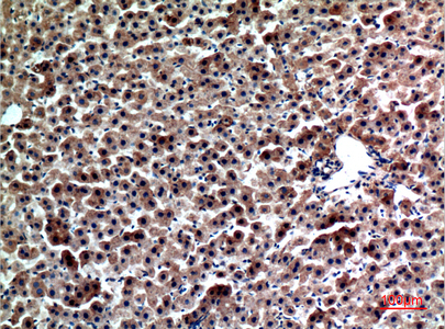 Immunohistochemistry validation of FGL1 using Anti-Hepassocin FGL1 Antibody (A05044-1)