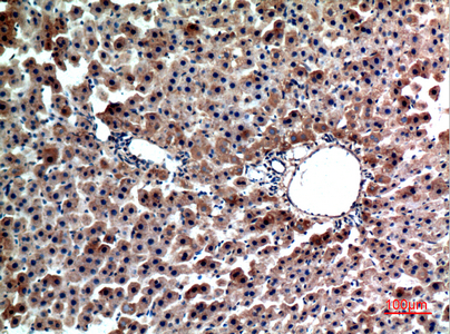 Immunohistochemistry validation of FGL1 using Anti-Hepassocin FGL1 Antibody (A05044-1)