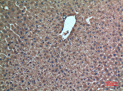 a05044 1 fgl1 primary antibodyes ihc testing 4