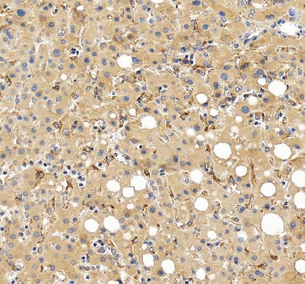 IHC analysis of FGL1 using anti-FGL1 antibody (A05044-2)
