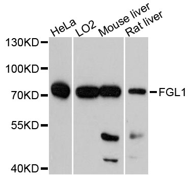 Western blot analysis of extracts of various cell lines, using FGL1 antibody at 1:1000 dilution