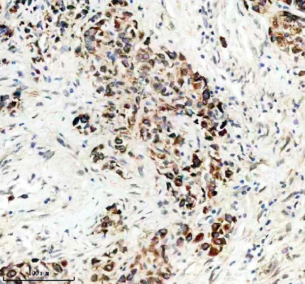 a05045 1 tcirg1 primary antibodies ihc testing 1