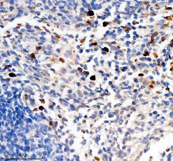 a05045 1 tcirg1 primary antibodies ihc testing 2