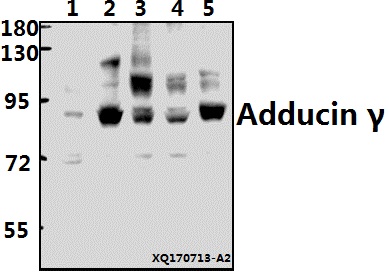 Western blot (WB) analysis of Adducin γ (P452) polyclonal antibody at 1:500 dilution
Lane1:BV2 whole cell lysate(40ug)
Lane2:PC12 whole cell lysate(40ug)
Lane3:LO2 whole cell lysate(40ug)
Lane4:A549 whole cell lysate(40ug)
Lane5:HepG2 whole cell lysate(40ug)