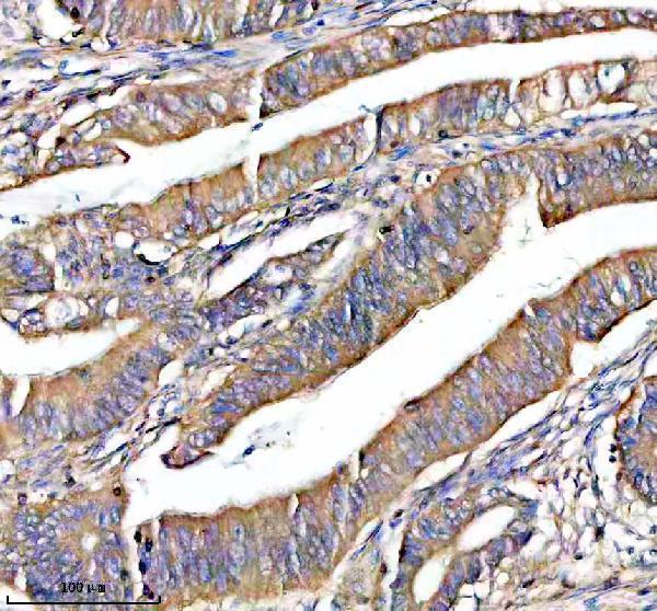  IHC analysis of NOXO1 using anti-NOXO1 antibody (A05047-2)