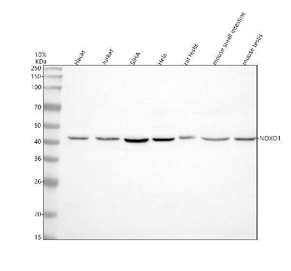  Western blot analysis of NOXO1 using anti-NOXO1 antibody (A05047-2)
