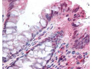 a05047 noxo1 primary antibodies ihc testing 1