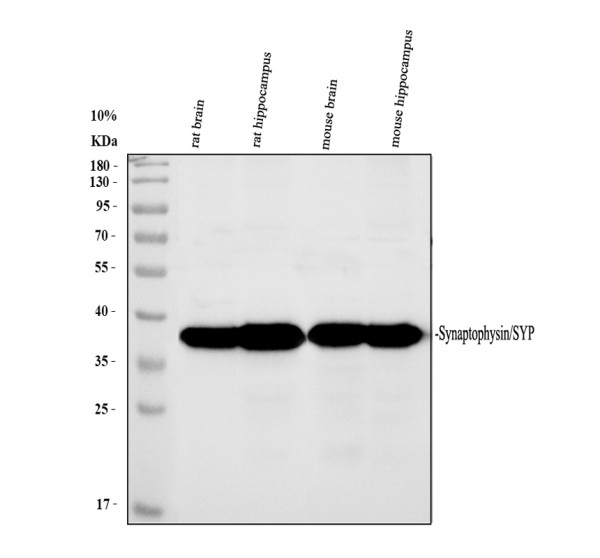 Western blot analysis of SYP using anti-SYP antibody (A05049)