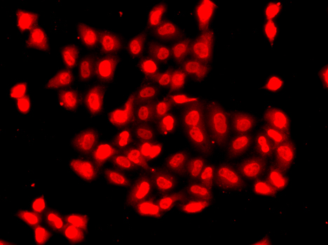 Immunofluorescence analysis of A549 cells using CAMK1D antibody 