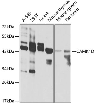 Western blot analysis of extracts of various cell lines, using CAMK1D antibody  at 1:1000 dilution