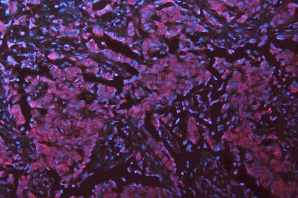 a05052 1 msi1 primary antibodies if testing 21