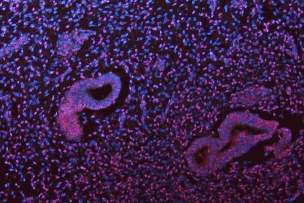 a05052 1 msi1 primary antibodies if testing 22